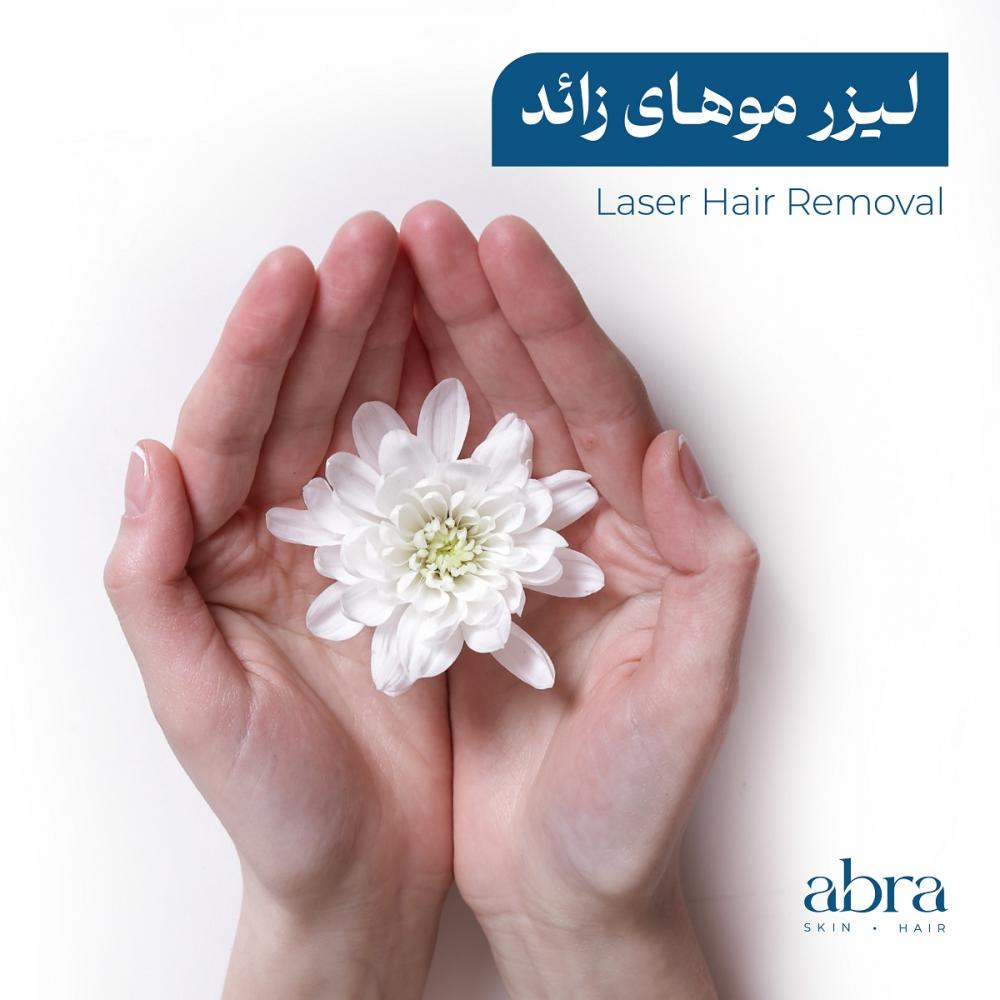لیزر موهای زائد بانوان در رشت