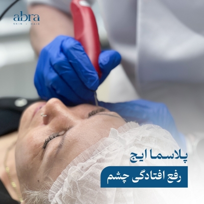 پلاسما ایج دکتر فیاض مقدم در رشت