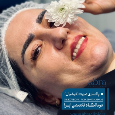 فیشیال (پاک سازی پوست صورت) در رشت